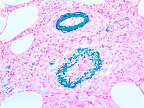 IHC of Actin, Muscle, Smooth-Muscle on a FFPE Appendix Tissue